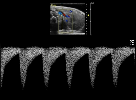 Mouse Renal Artery PW Doppler