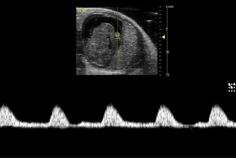 Mouse Umbilical Artery Flow at Mid-Gestation.jpg