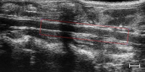 Mouse-Abdominal-Aorta.jpg