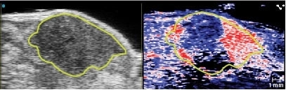 Pancreatic tumor oxygen saturation.jpg