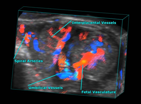 Placenta-and-fetus-color-3D-rendered-and-labelled.jpg