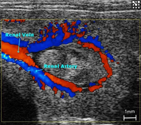 Rat-kidney-color.jpg