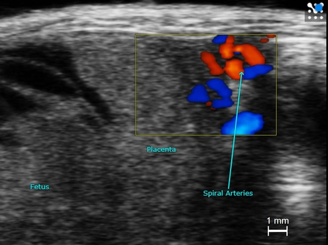 Spiral Arteries in a Mid-Gestation Mouse Placenta.jpg