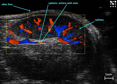 Splenic-Vasculature.jpg