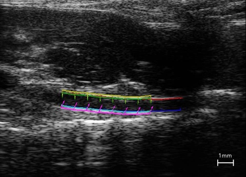 VevoVasc-of-abdominal-aorta.jpg