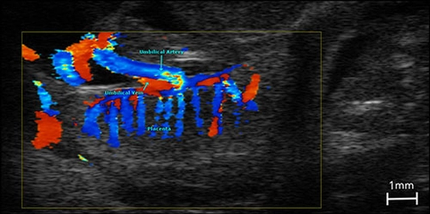 colour Placenta and embryo.jpg