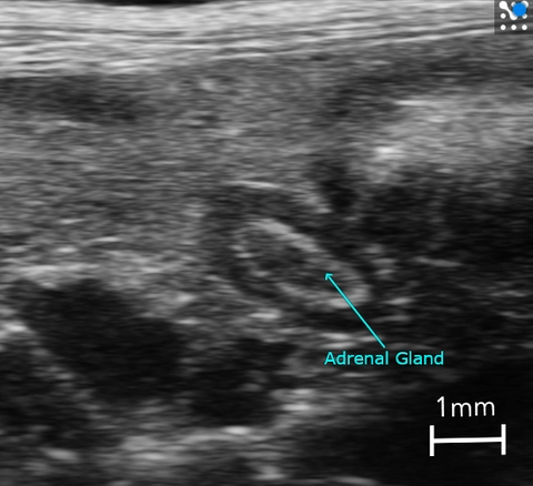 Adrenal_mouse-b-mode.jpg