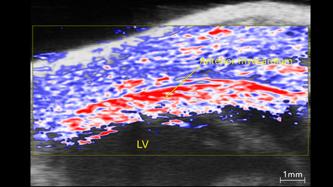 Anterior myocardium oxygenation, high O2 stats in red, low in blue.jpg