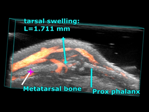 Arthritic-Joint.jpg