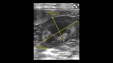 Canine left kidney with measurements.jpg