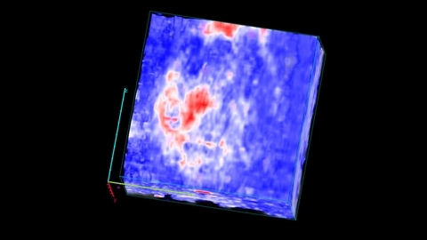 Cerebral oxygenation after carotid artery occlusion.jpg