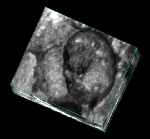 Embryo-B-Mode-3D.jpg