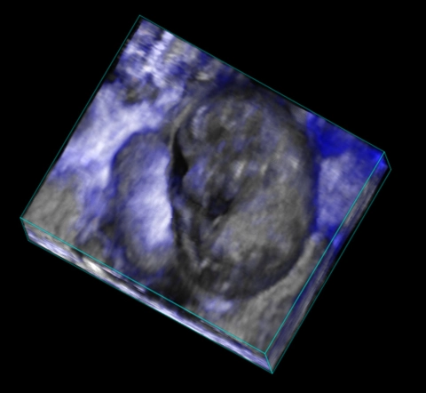 Oxygen Saturation In E14 Mouse Embryo And Placenta | FUJIFILM VisualSonics