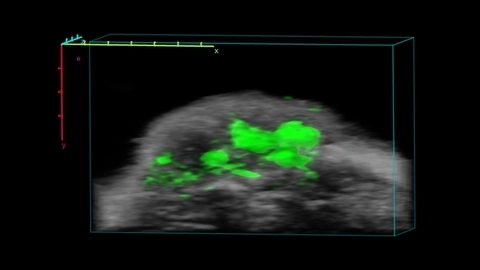 ICG localization in tumor.jpg