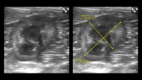 Left kidney in small dog with measurements - L38xp transducer.jpg
