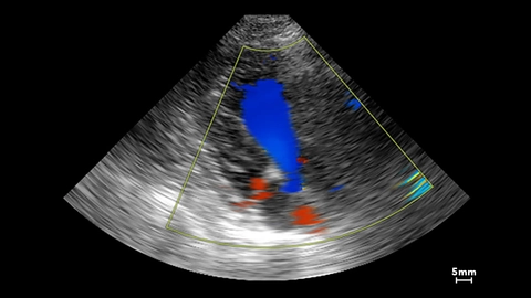 Mitral flow in a small dog.jpg