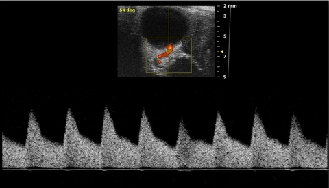 Mouse Uterine Artery Blood Flow at Late Gestation_.jpg