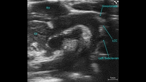 Mouse aortic arch - UHF57x.jpg