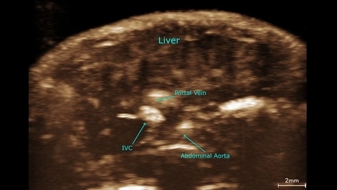 Mouse liver contrast MIP - UHF29x.jpg