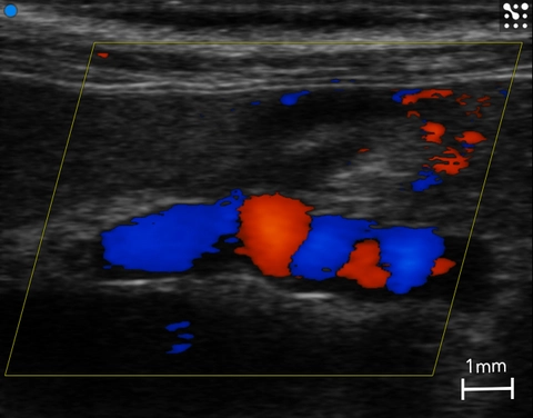 Mouse Portal vein with swirling flow.jpg