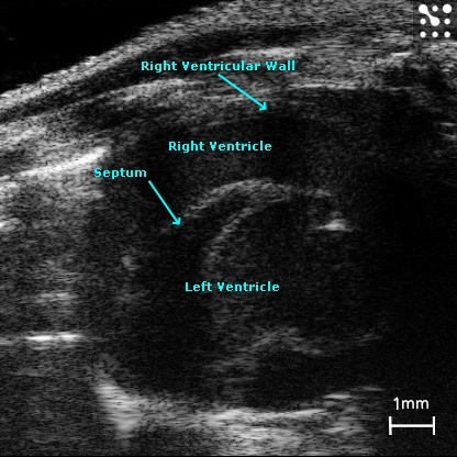 Mouse Right Ventricle | FUJIFILM VisualSonics