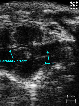 Mouse Coronary Artery