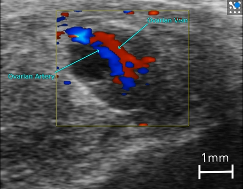 Ovarian-Artery-and-Vein-in-a-Mouse.jpg