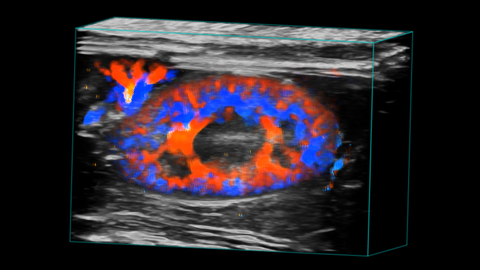 Rat kidney vasculature in 3D color - UHF29x - 15-29MHz.jpg
