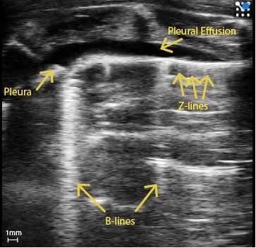 Rat pleural effusion and thickening.jpg