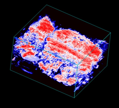 Rt-HL-post-reperfusion-oxyhemo-3D.jpg