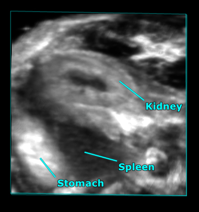 Spleen-kid-stom-Bmode-render-labeled.jpg