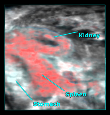 Spleen-kidney-stomach-fusion-render-labeled.jpg