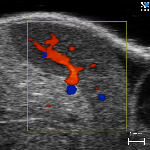 Splenic-Vasculature-2.jpg