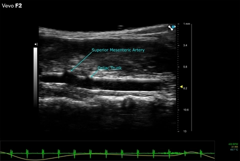 UHF46x - Mouse abdominal aorta.jpg