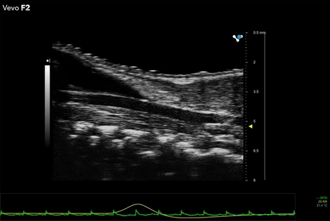 UHF71x - Mouse carotid artery.jpg