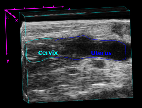cervix-uterus_saggital.jpg