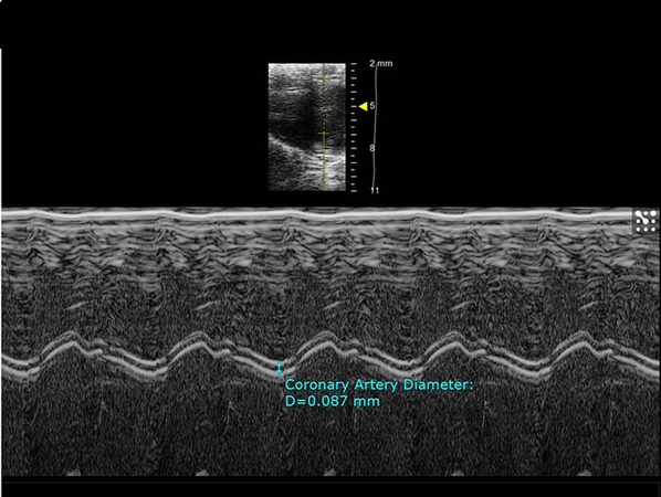 Coronary Artery M-Mode.jpg