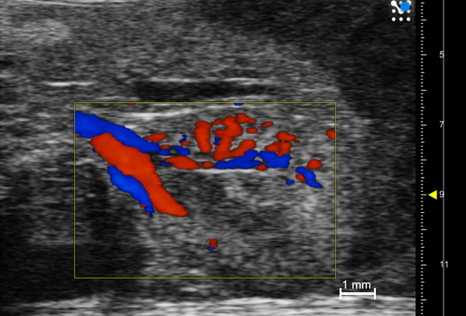 Renal Vasculature with Color Doppler in the Mouse.jpg