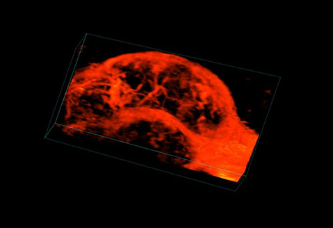 3D Power Doppler Image of a Mammary Tumor in a Mouse