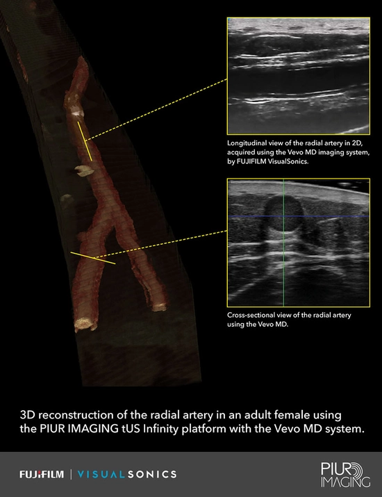 3D Ultrasound Imaging 