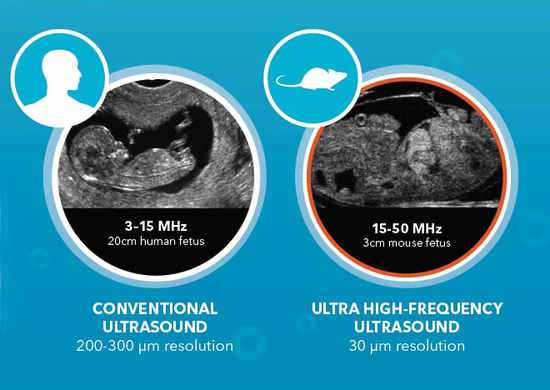 Conventional vs. Ultra-high Frequency Ultrasound