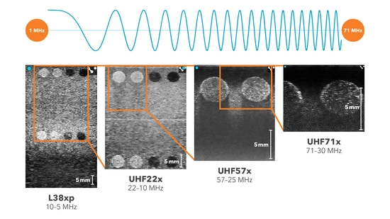 Wavelength moving from left to right (1-71 MHz), phantom image scanned using L38xp, UHF22x, UHF57x and UHF71x showing the depth.