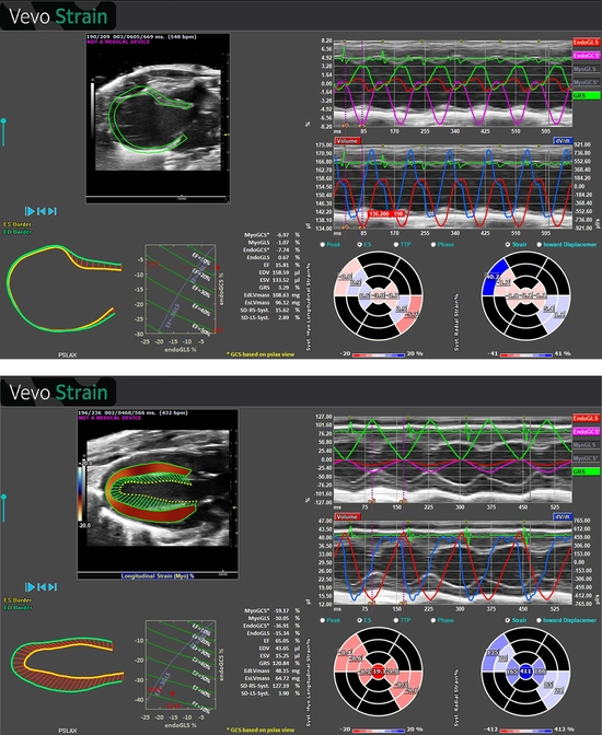 Vevo Strain 2.0 Analysis Screens showing normal heart and infarcted heart.